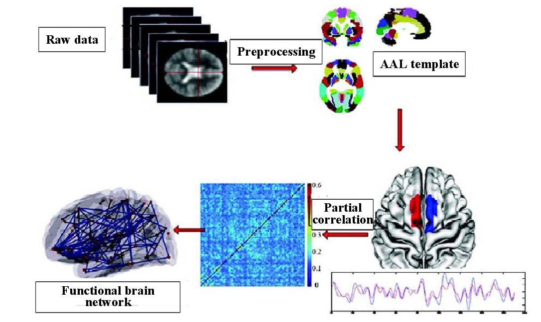 brainp2