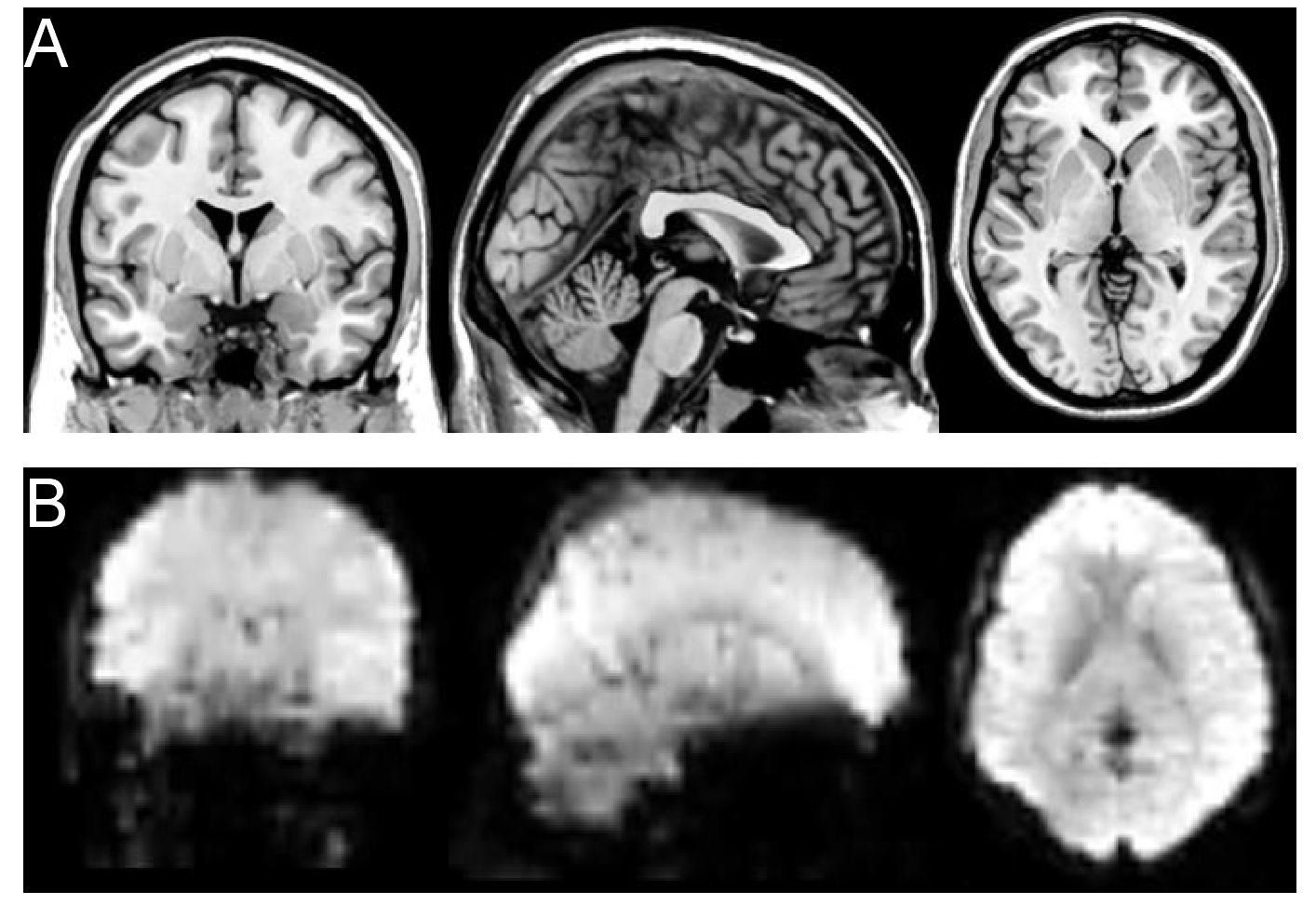 brainp3
